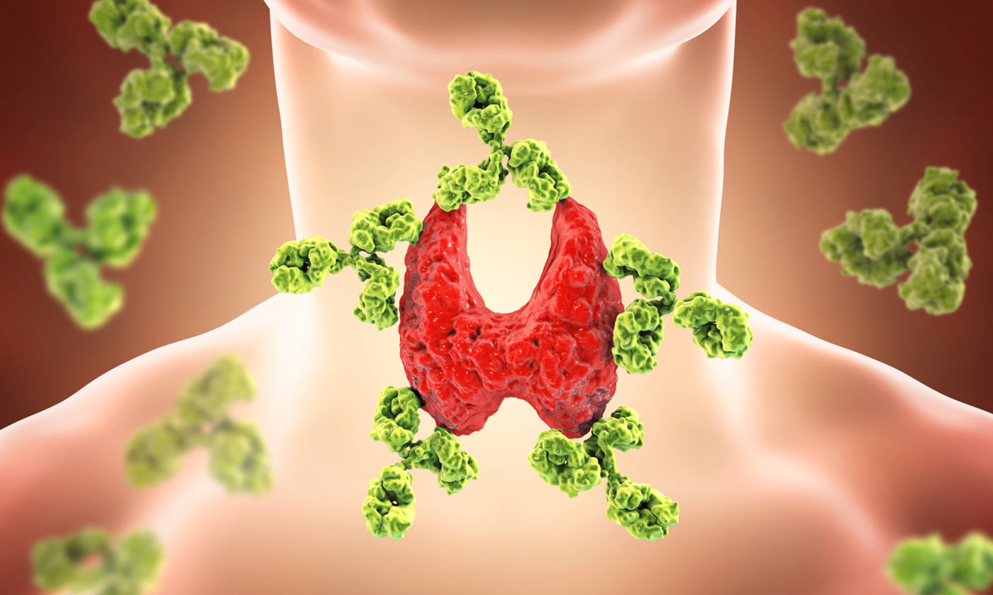 Autoimmunkrankheiten Hypnose Zürich